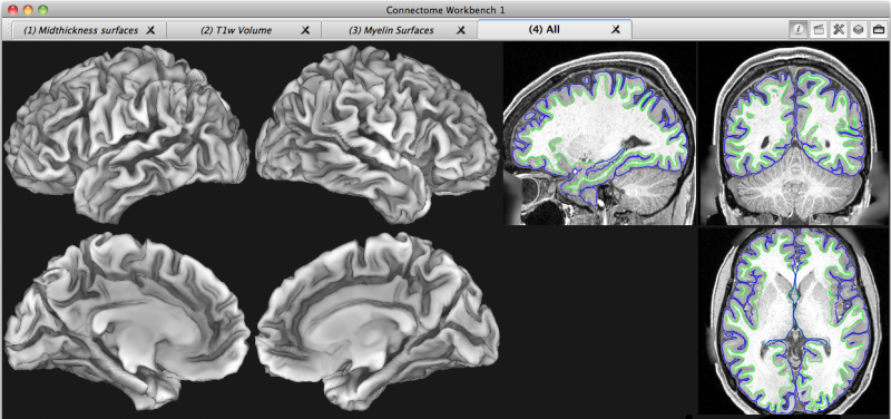 /art/cropped-images/cropped-images/connectome-workbench-b82-2-0-0-0-0-1480630741-0-0-800-376-1718659962.png